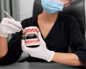 Best-Veneer