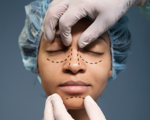 Choosing-the-Best-Cosmetic-Surgeon-in-India-10-Key-Questions-to-Ask-Especially-for-Hyderabad-Patients-Mobile_Banner