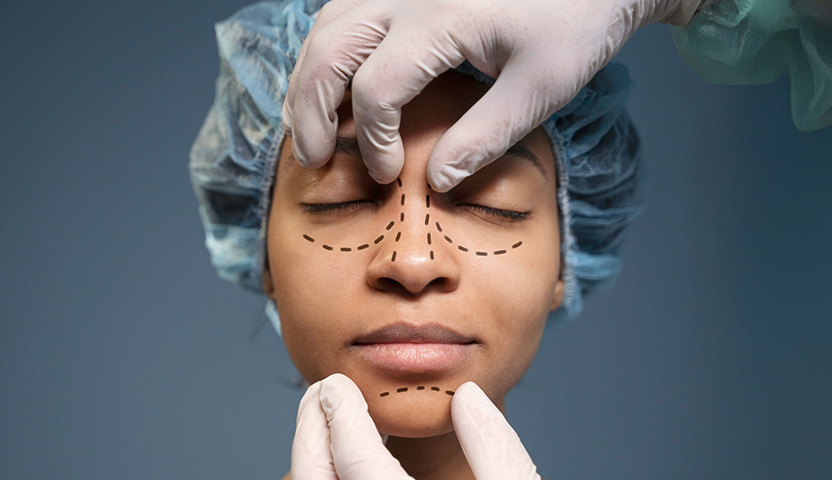 Choosing-the-Best-Cosmetic-Surgeon-in-India-10-Key-Questions-to-Ask-Especially-for-Hyderabad-Patients-Mobile_Banner