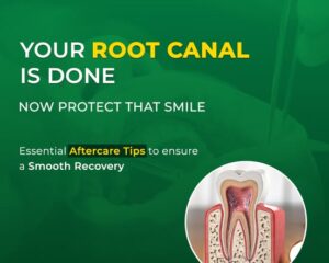root-canal-treatment-cost-in-noida-2