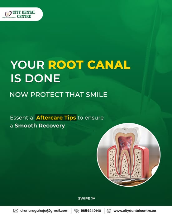 root-canal-treatment-cost-in-noida-2