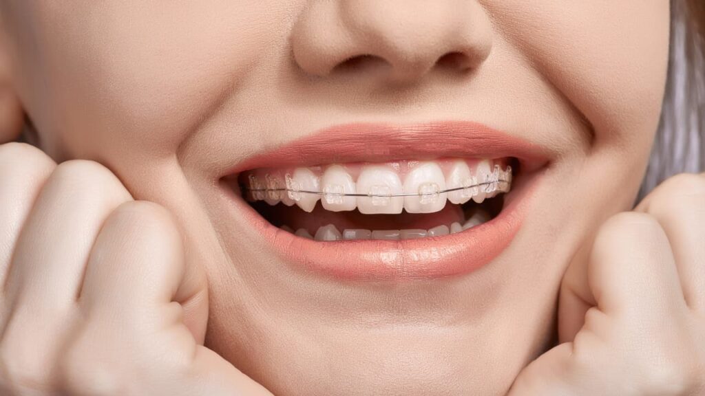 braces-Zetland-1