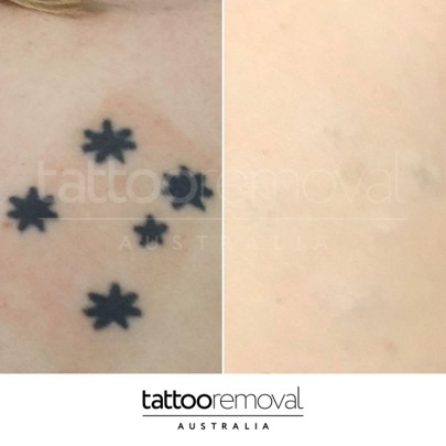 6a2aa25ebf49b6b7295258db_Before-and-after-skin-results