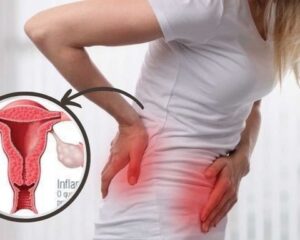 endometriosis-treatment-in-delhi