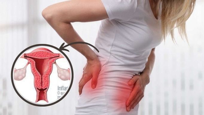endometriosis-treatment-in-delhi