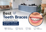 Best-Teeth-Braces-in-Kathmandu-Nepal-for-Smiles