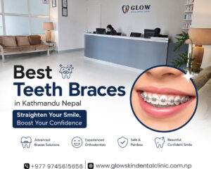 Best-Teeth-Braces-in-Kathmandu-Nepal-for-Smiles