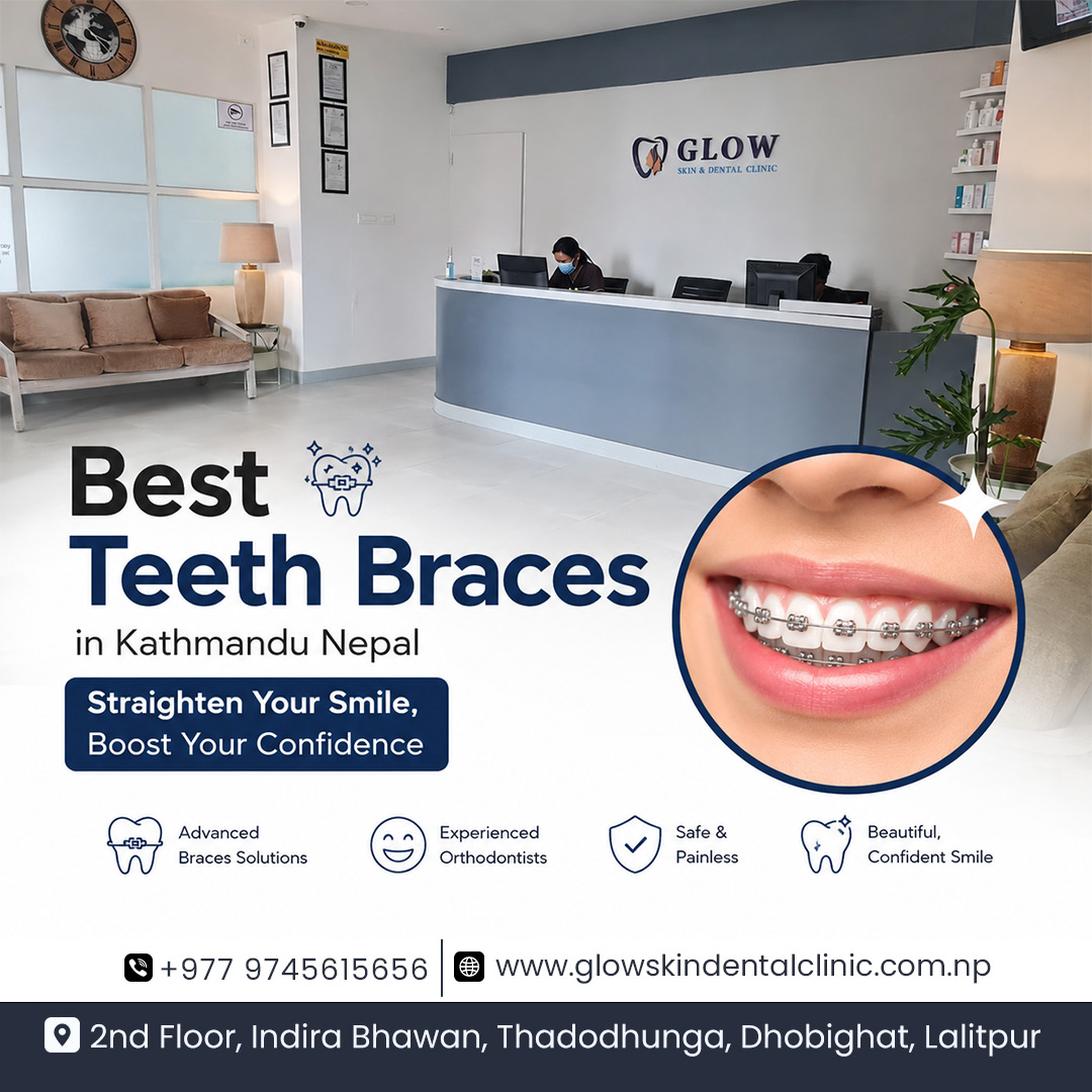Best-Teeth-Braces-in-Kathmandu-Nepal-for-Smiles
