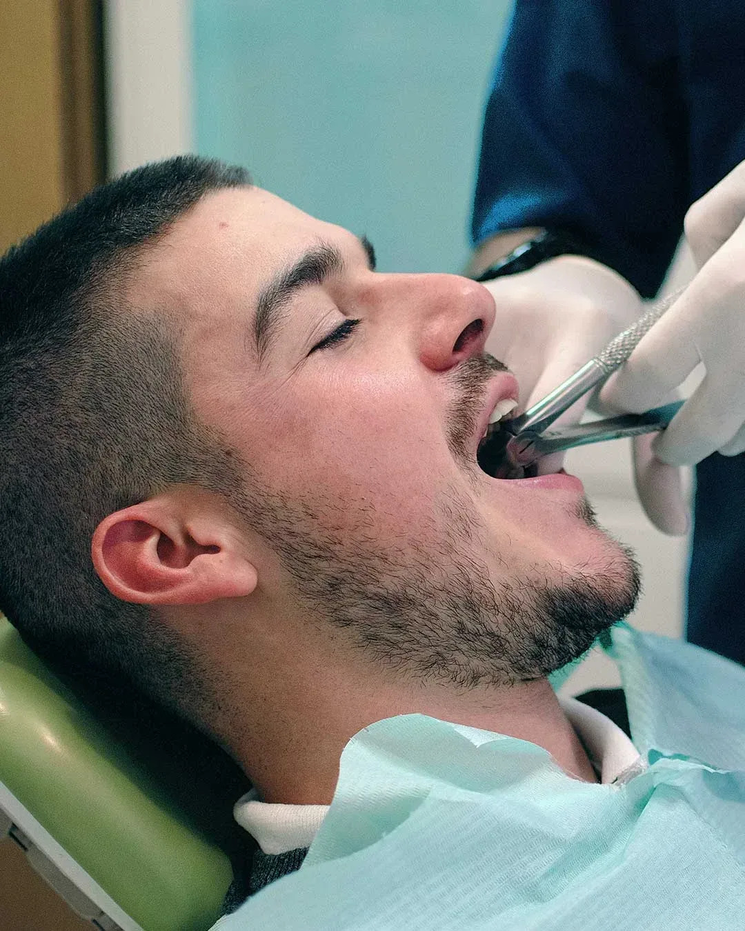 wisdom-tooth-extraction